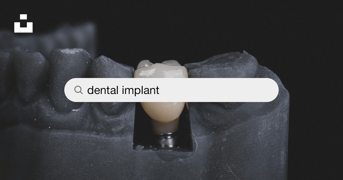 CBCT: Safe and Accurate Dental Implant